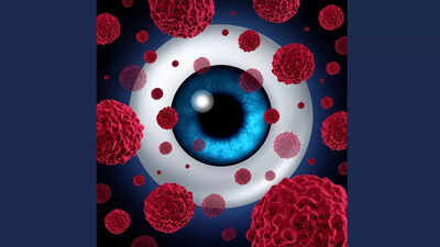 Eye cancer common signs and symptoms that you should know |